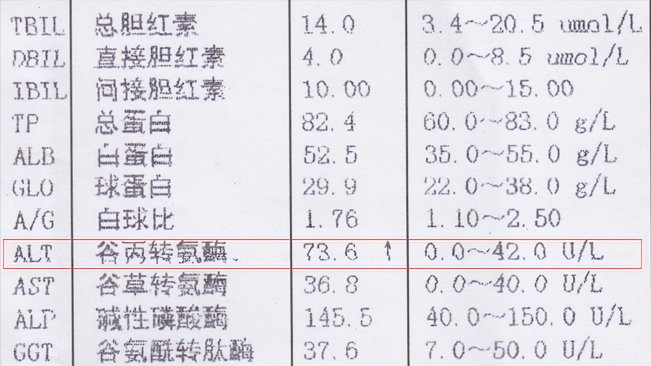 身體出現這4個症狀,可能是肝損傷了!檢查哪些指標可以看出來?