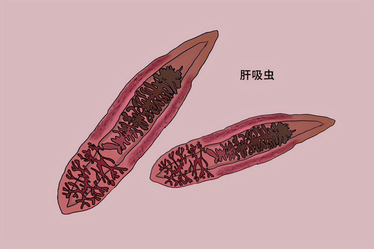 連續腹痛,腹瀉2個月,檢查後發現腸道佈滿寄生蟲,咋回事?