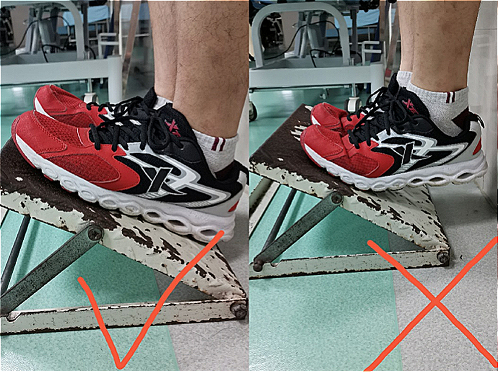 脑梗偏瘫后,站斜板锻炼的正确方法 #脑梗偏瘫正确康复训练#  患者取