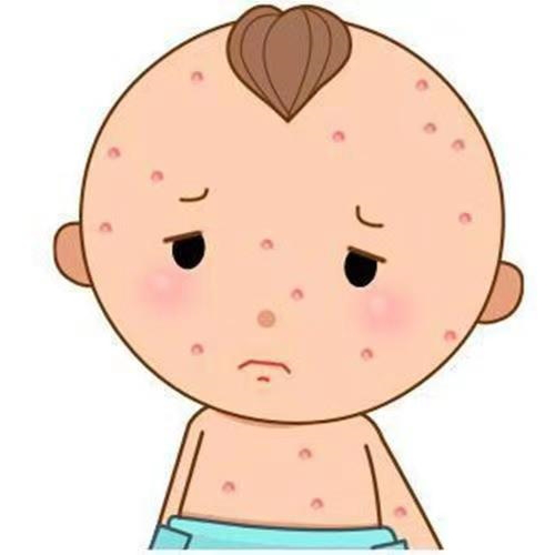 宝宝出现水痘,要及时处理,在日常中做到有效预防