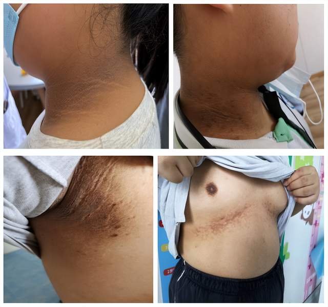 娃身上这几个地方变黑,是这个病的早期信号,快检查!