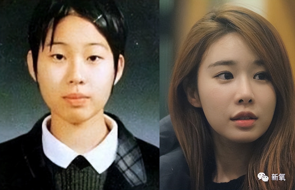 整形真的出不了大美女吗?