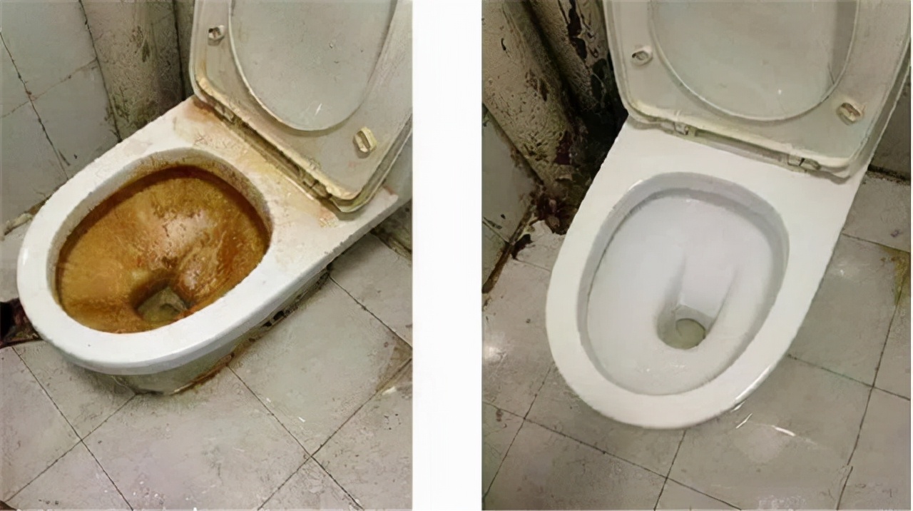 马桶内壁上会积累不少细菌和污垢,清理很重要