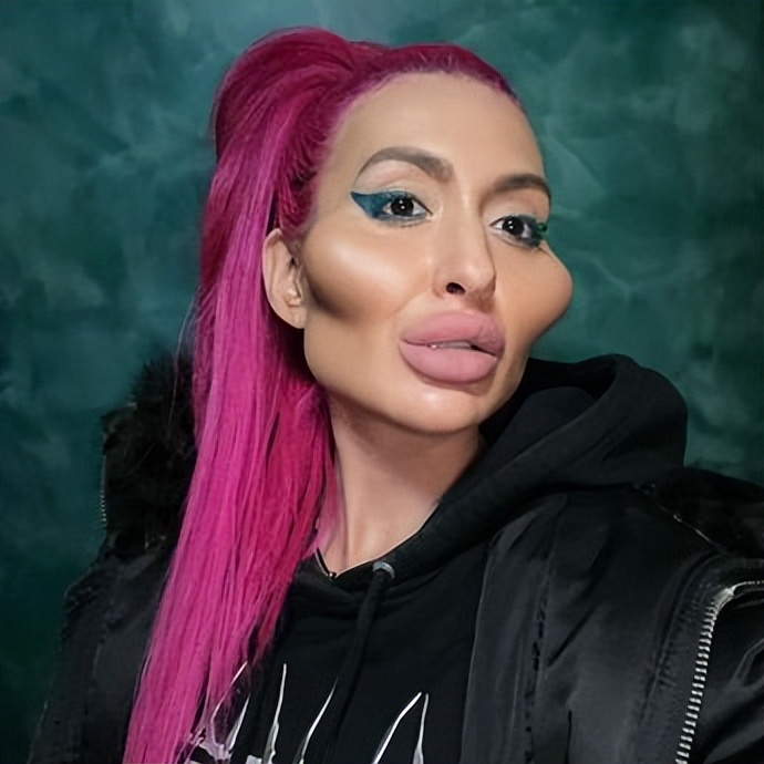 外国女子颧骨高耸大如馒头,自信晒出来感到很美,还想要更大的