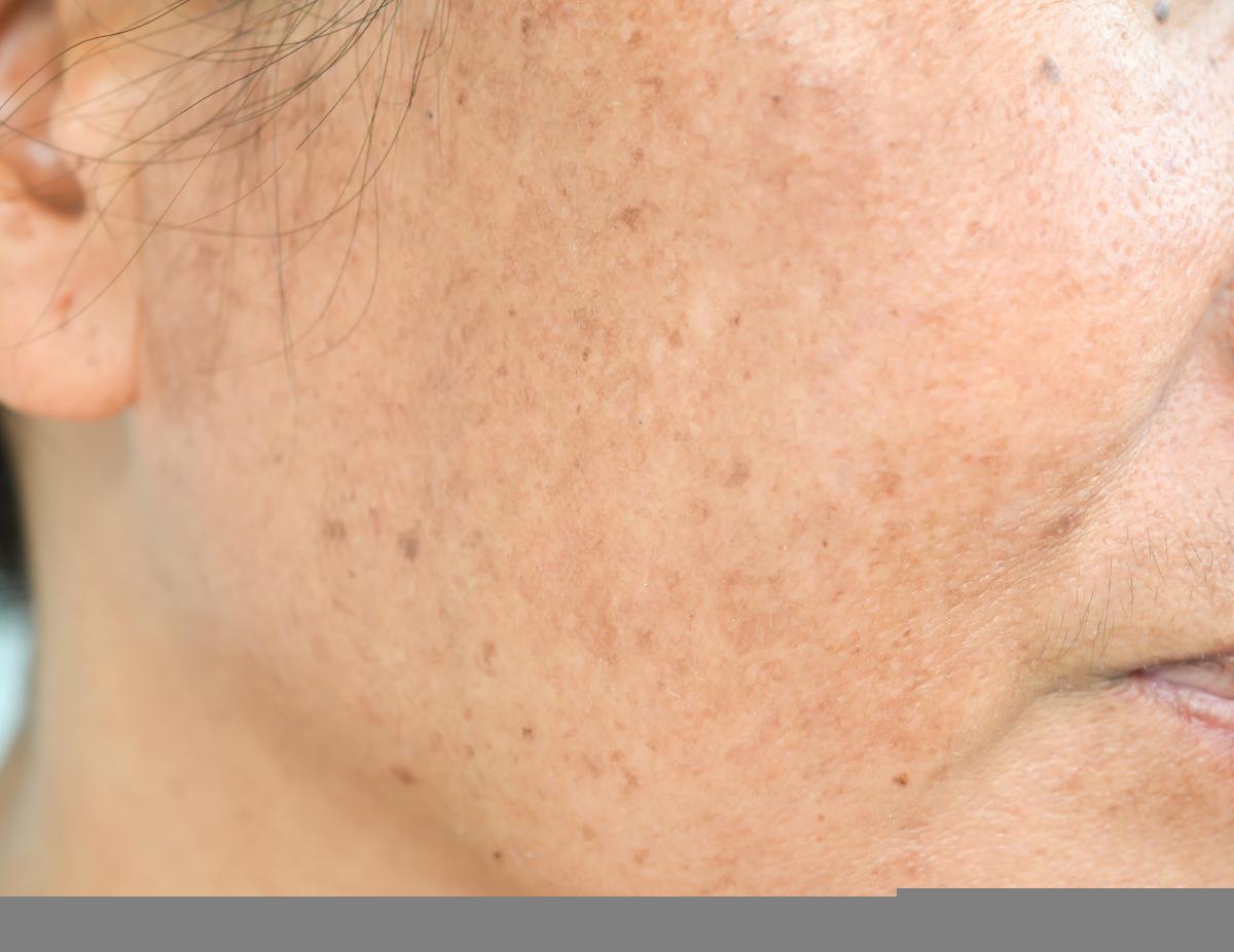 脸色暗黄,素颜感人?掌握三个关键方法,就能提升肌肤的亮白度