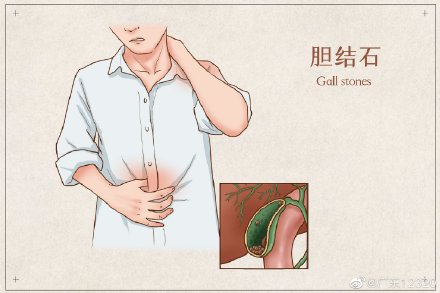 男性胆结石疼痛位置图图片