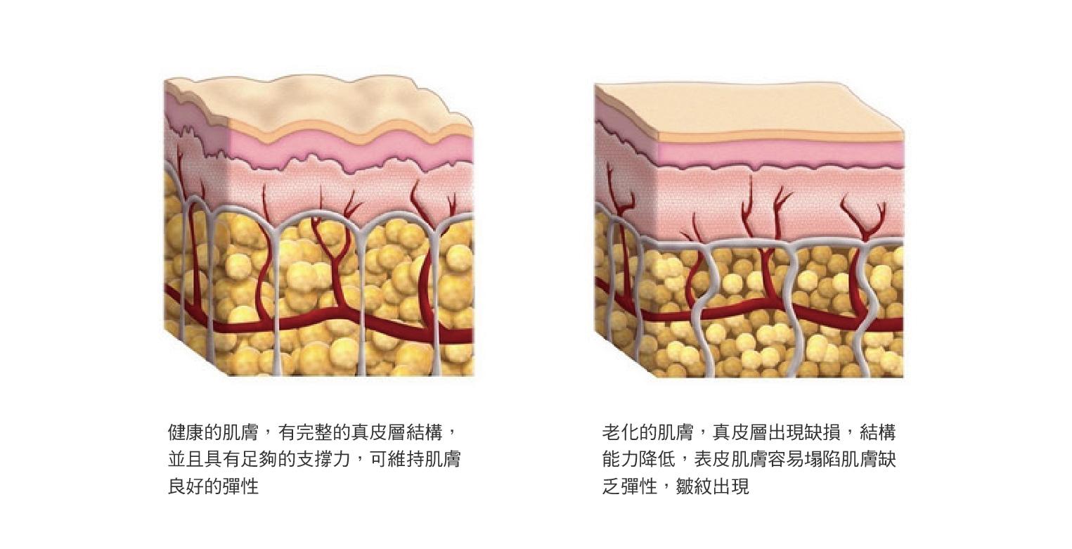 大腿脂肪萎缩图片图片