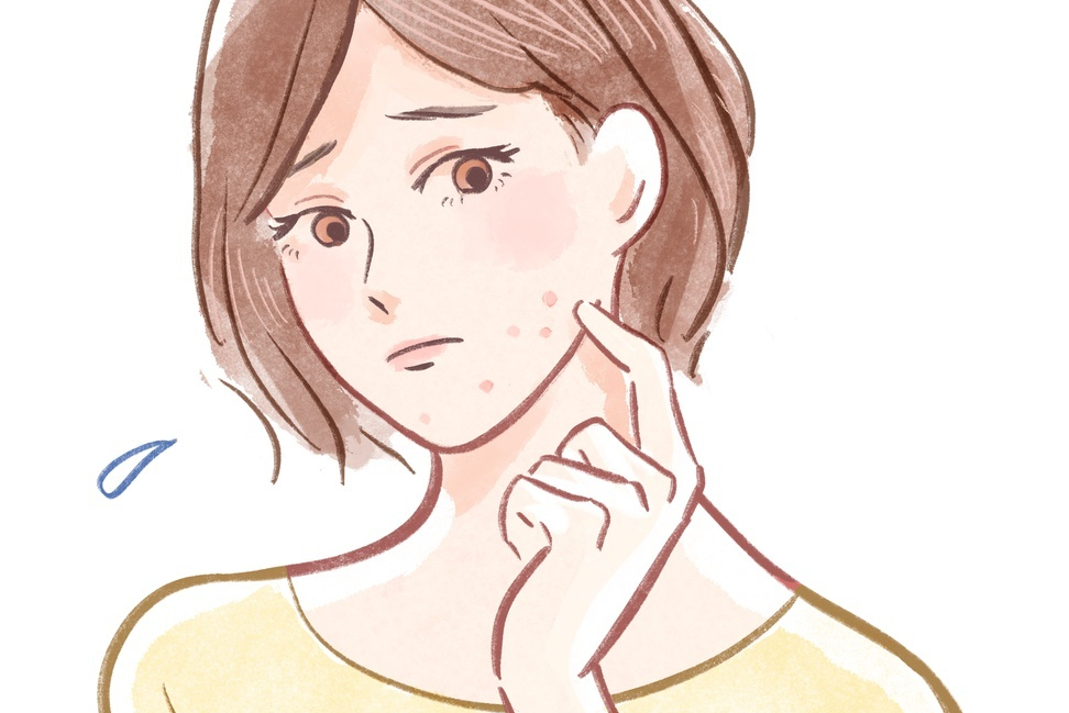 油痘肌公主们必看指南