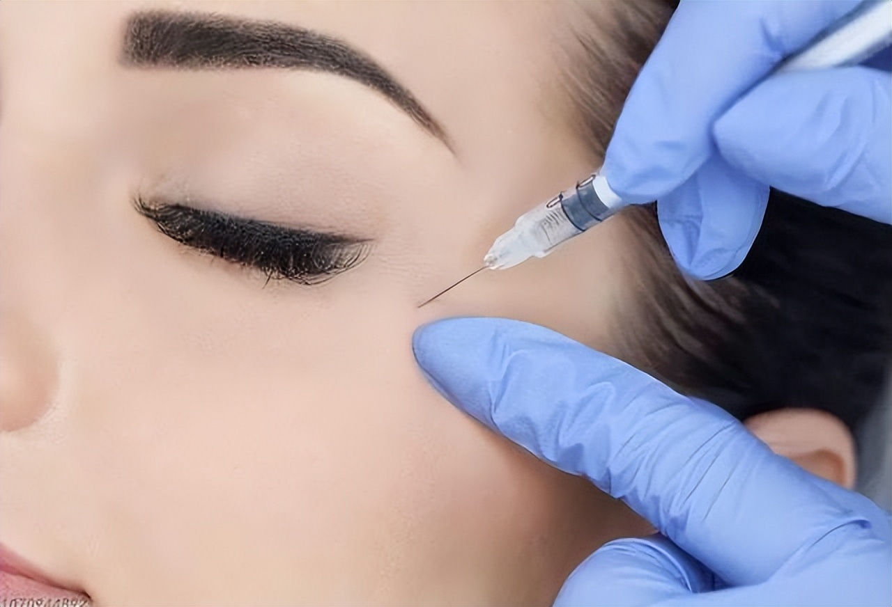 使用除皱针要了解去皱纹的核心,并关注使用肉毒素应注意的问题