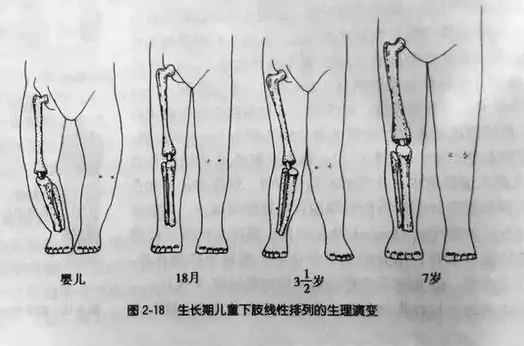 佝偻病可由维生素d不足