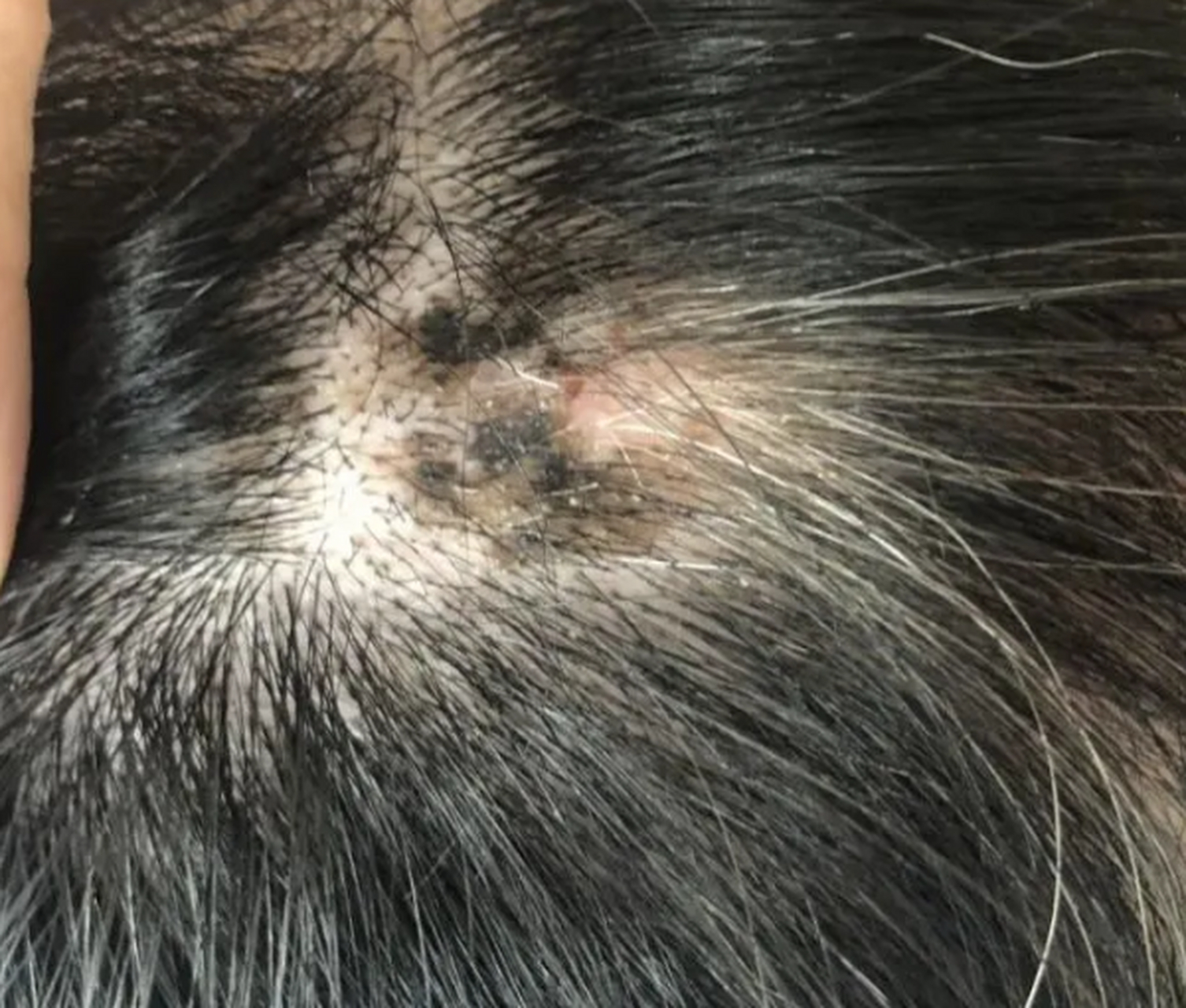 婆婆说这个痣好久了,应该没事儿.