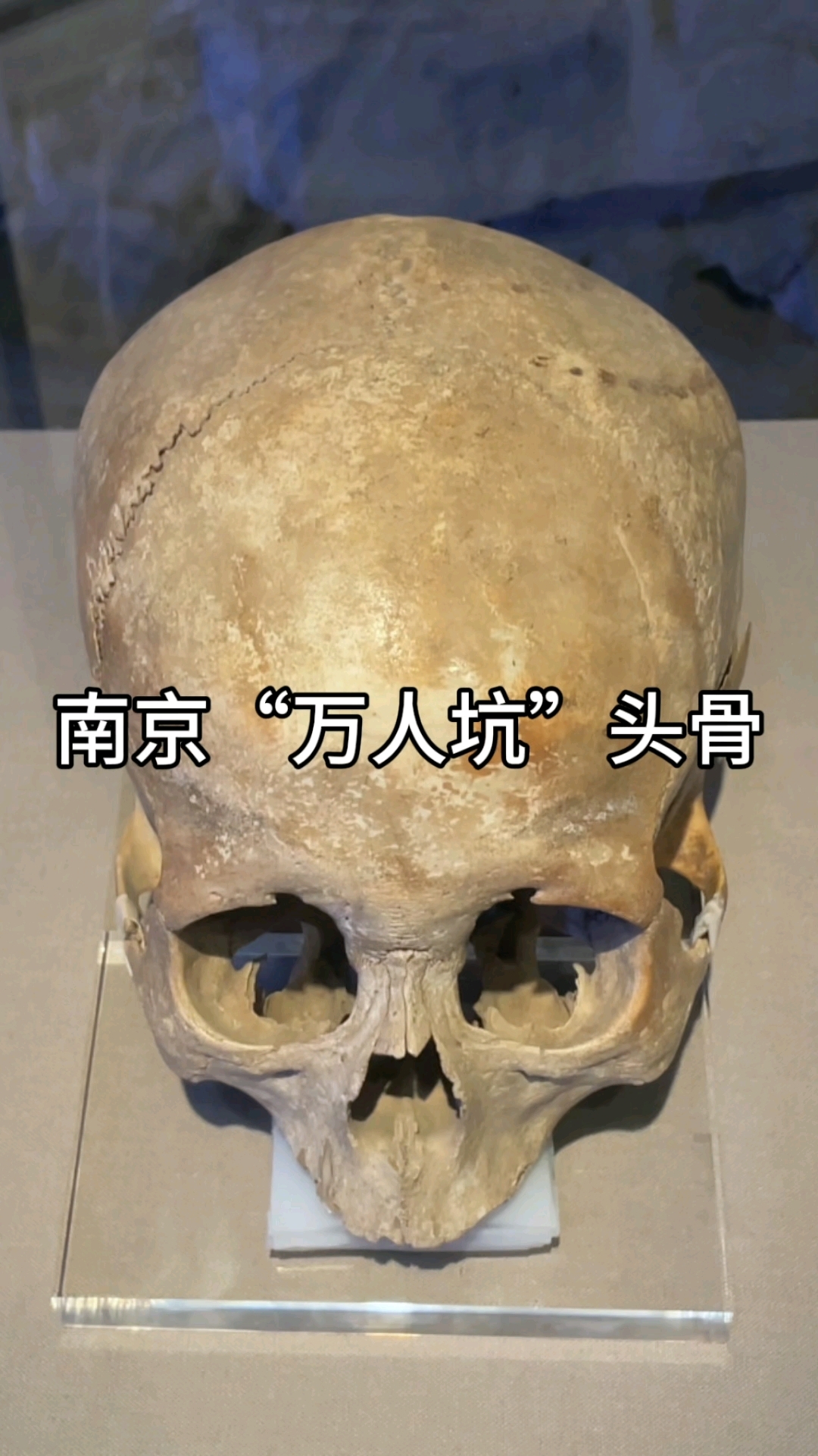 南京"万人坑"头骨