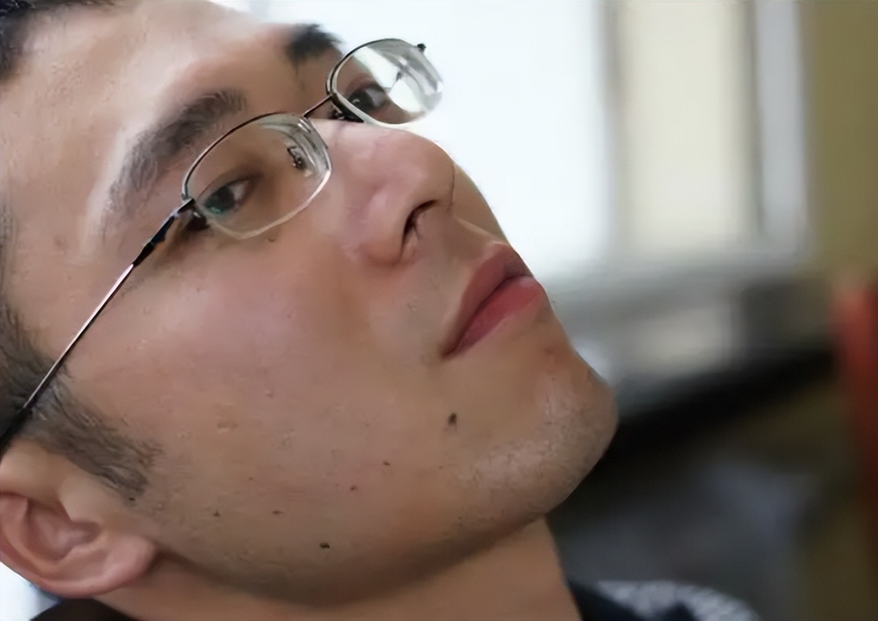 "鼻毛变白"是衰老的前兆吗?或许还有其他原因,男性朋友要注意