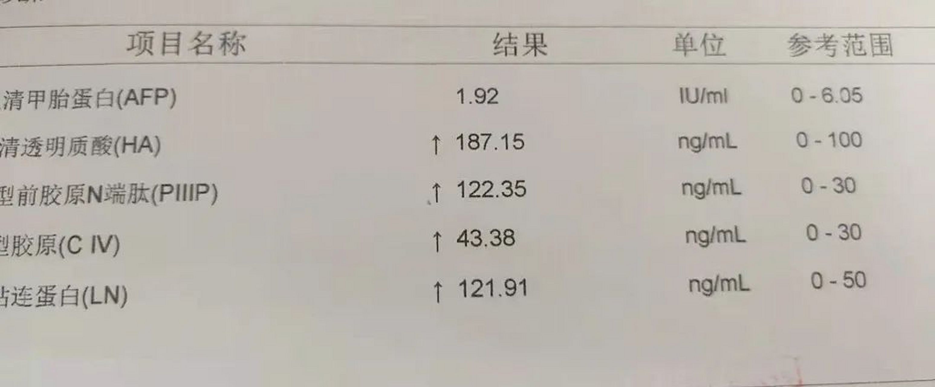 纤维化指标,四项全高,纤维化作为肝硬化的过渡阶段该怎么阻断?