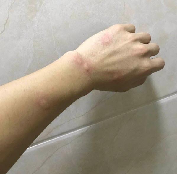 蚊子最大的天敌,竟然不是蚊香?教你个小窍门,5分钟蚊子绕道走