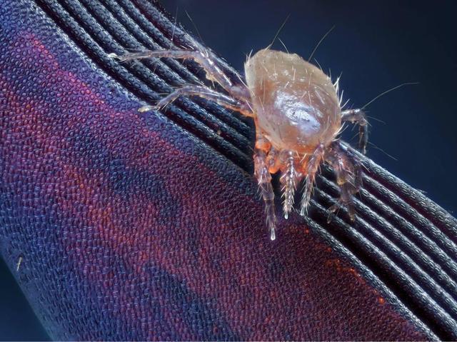 九成人不晓得"螨虫的克星"是啥?教你1个土法子,螨虫全消失了