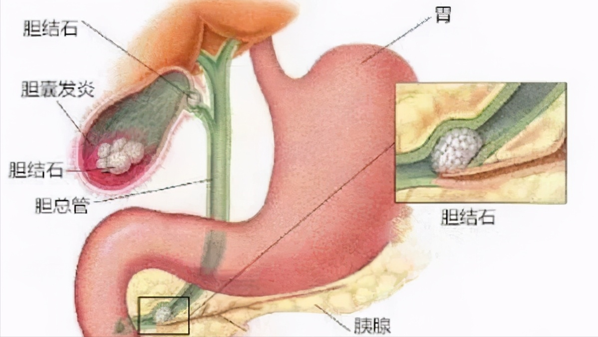 胆囊和胃的连接图图片