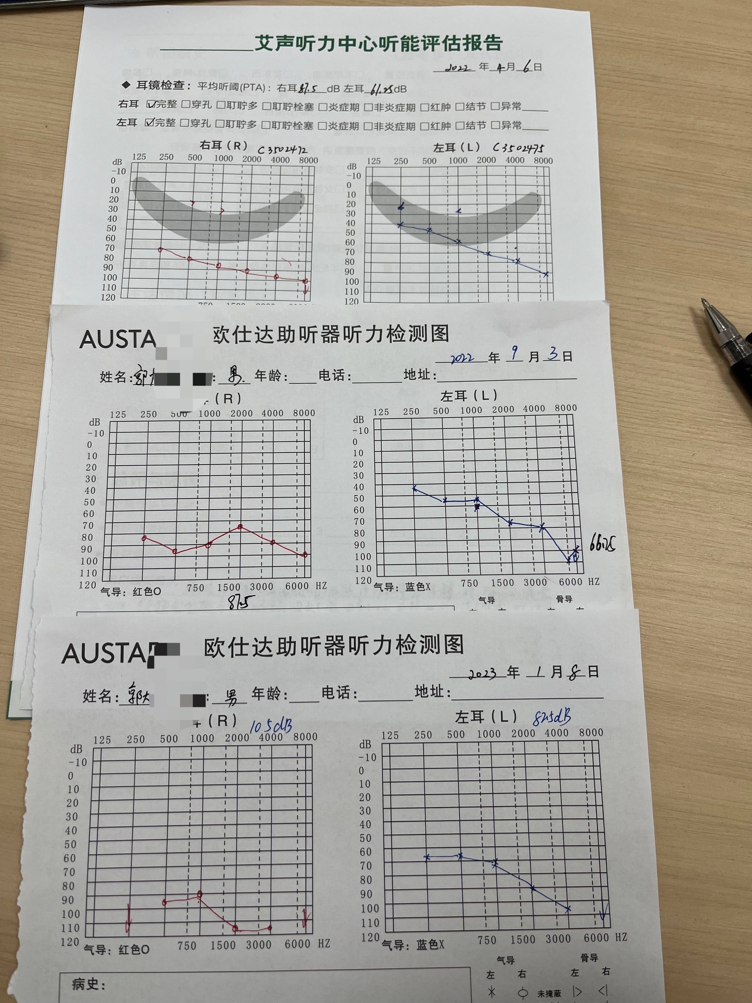 2人前後聽力對比圖看清陽過後的聽力變化