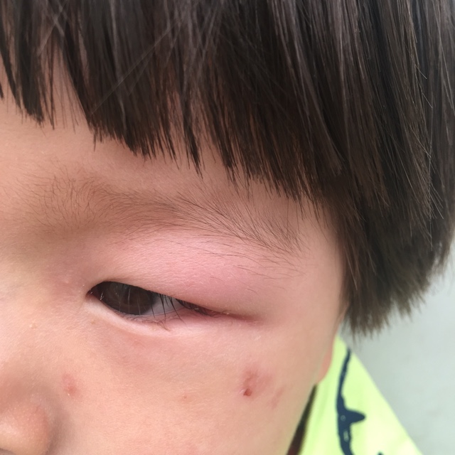 九成人不懂蚊子"天敌"是啥?教你一招,仅仅只要5分钟,蚊子跑光光