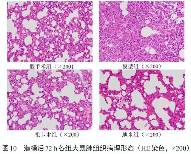 祖卡木顆粒及寒喘祖帕顆粒基礎研究最新報道