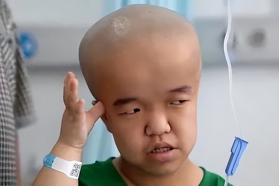 让30万婴儿成大头娃娃的凶手,三鹿奶粉董事长田文华,如今将出狱