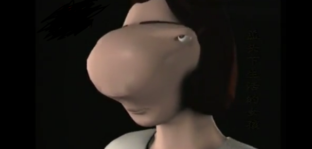 故事:浙江女童长"马脸",躲藏13年不敢出门,医生帮她换脸重生