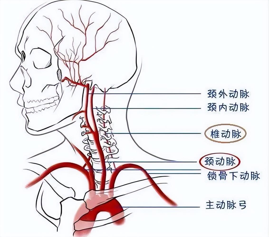 颈动脉做什么检查图片