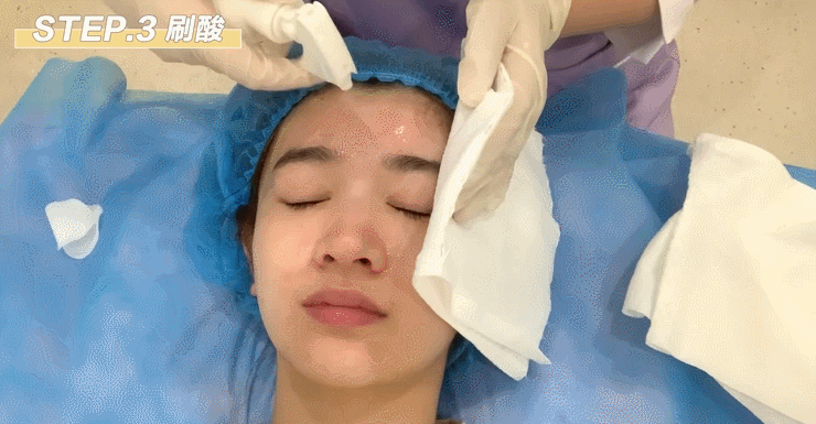 火爆全网的"刷酸"到底有多神奇?