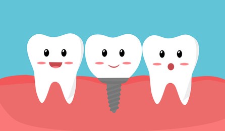 福州中泽口腔|种牙iti是什么品牌?种植牙iti好不好?