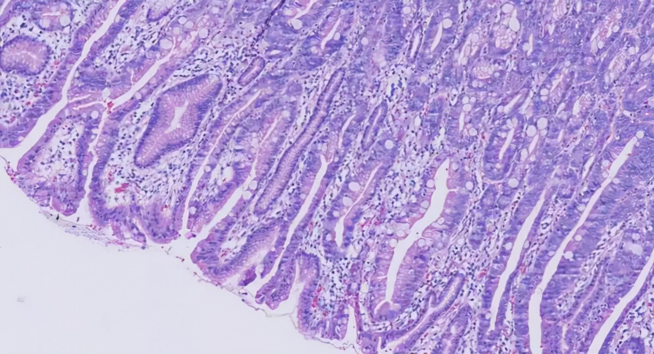 颌下腺炎有哪些致病原因?有哪些方法可以让医生更好地坚持?
