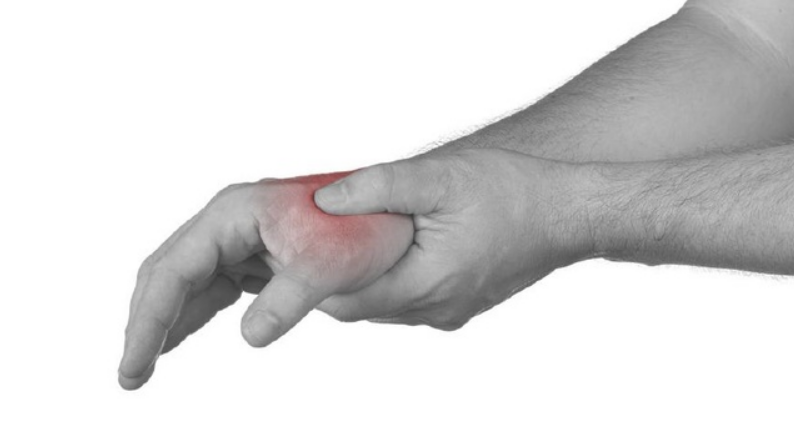 桡骨茎突狭窄性腱鞘炎,主要的临床表现为桡骨茎突处疼痛
