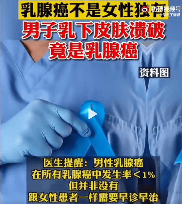 男子乳下皮肤溃破竟是乳腺癌,男性也会得乳腺癌吗?医生:会!