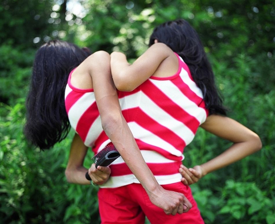 美国罕见的"双头人",两姐妹共用一个身体,却爱上不同男人