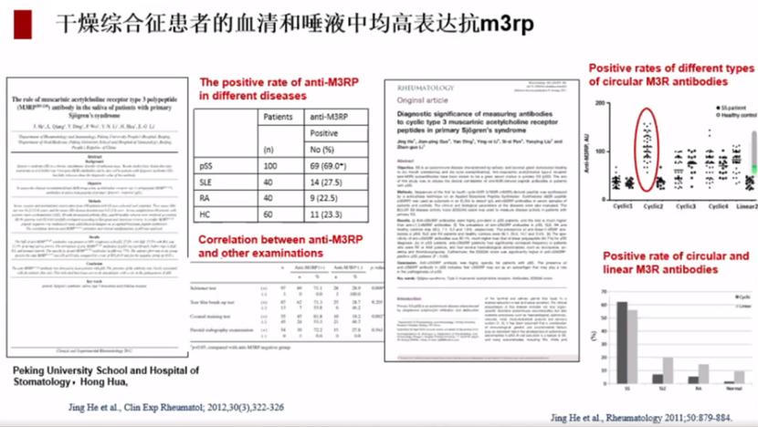 诊断干燥综合征被延误10年?不要怕,新指标来了