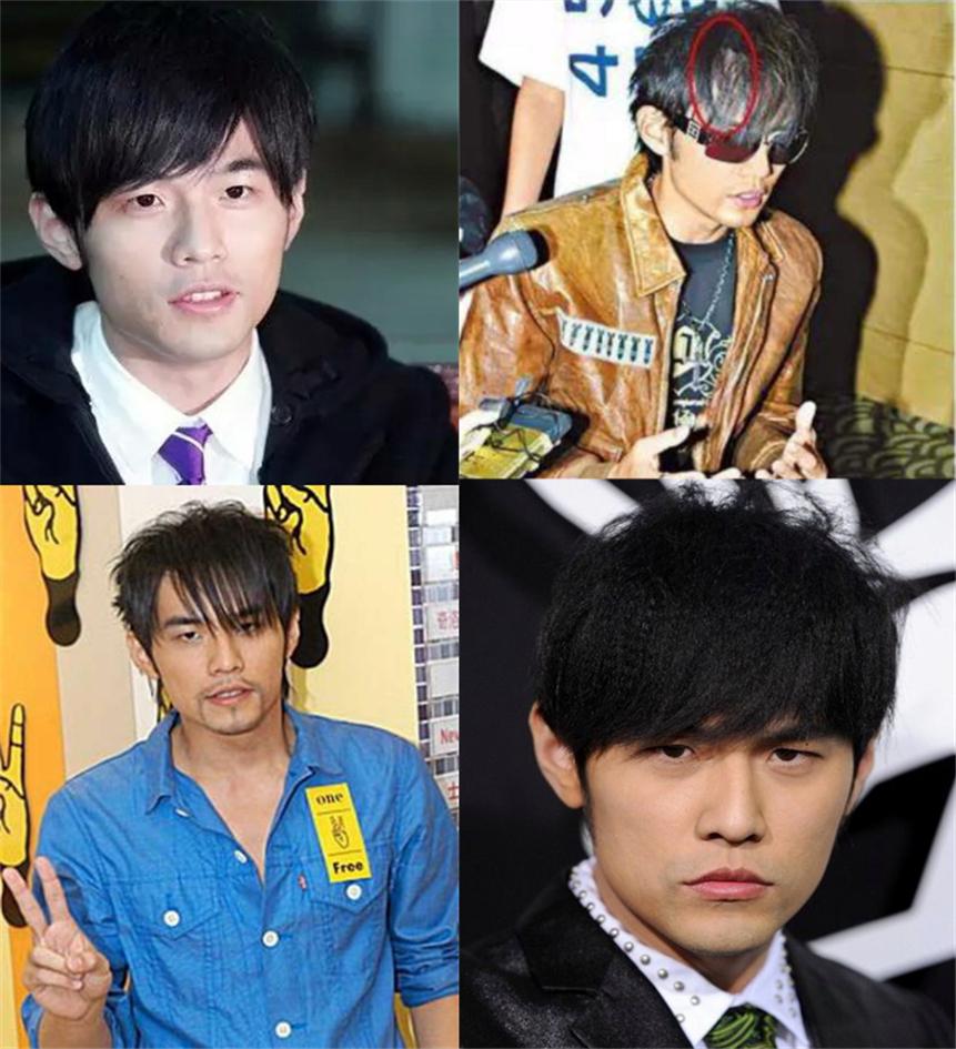 原来男星早就秃了黄晓明周杰伦头顶稀疏观众被骗惨了