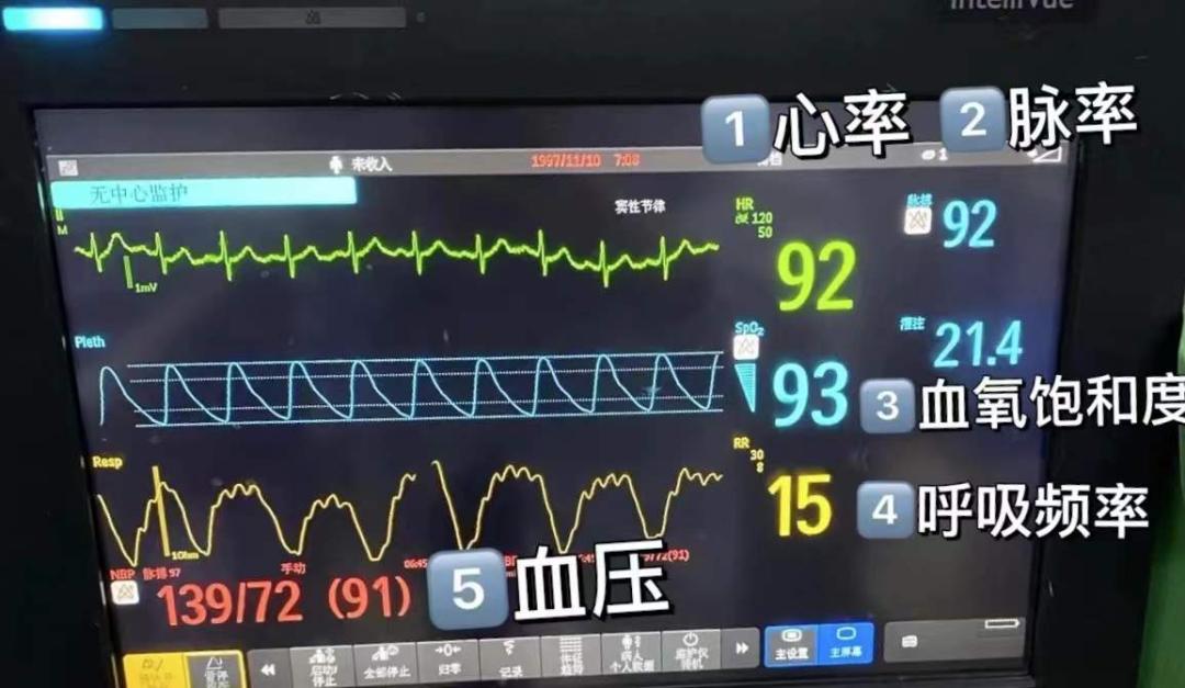 心电监护仪显示死亡图图片