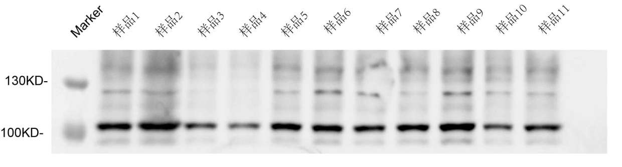 蛋白质印迹法图像结果分析wb检测技术