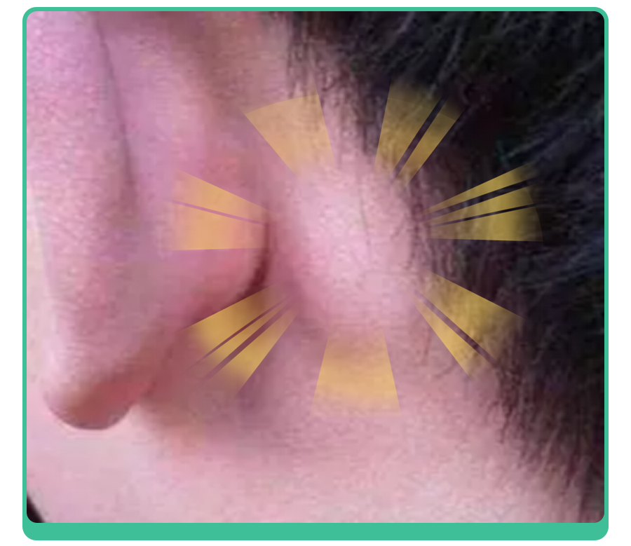 孩子出现鼻窦炎,听力下降等症状,莫非是耳后"鼓包"在作祟?