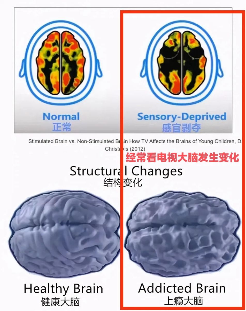 神经科学家:娃3岁前看电视,在7岁前注意力出问题的可能性会更高