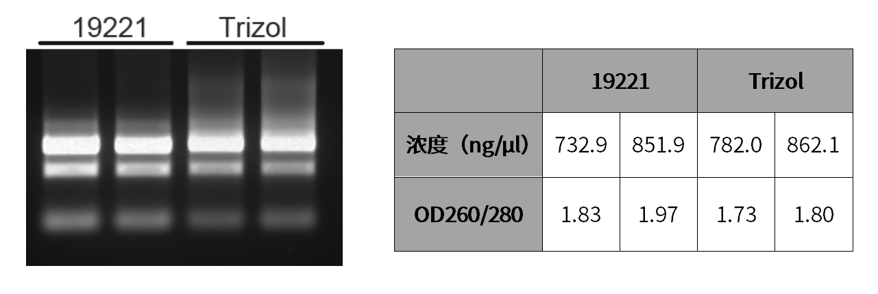 组织/细胞RNA提取指南，彻底摆脱选择综合征！