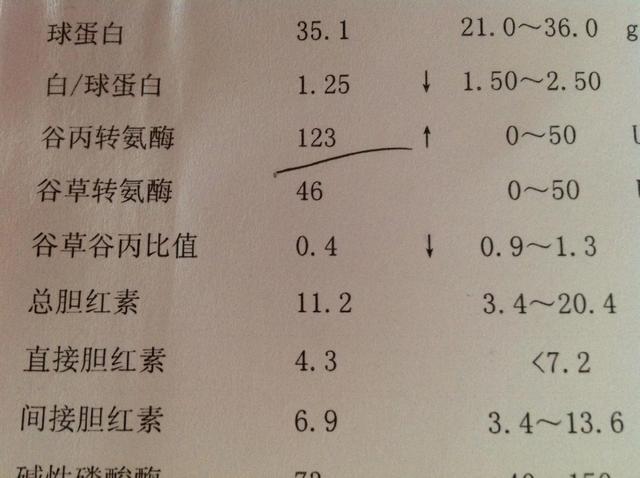 若转氨酶升高,医生建议:拒绝3种食物,或能降低对肝脏的损伤