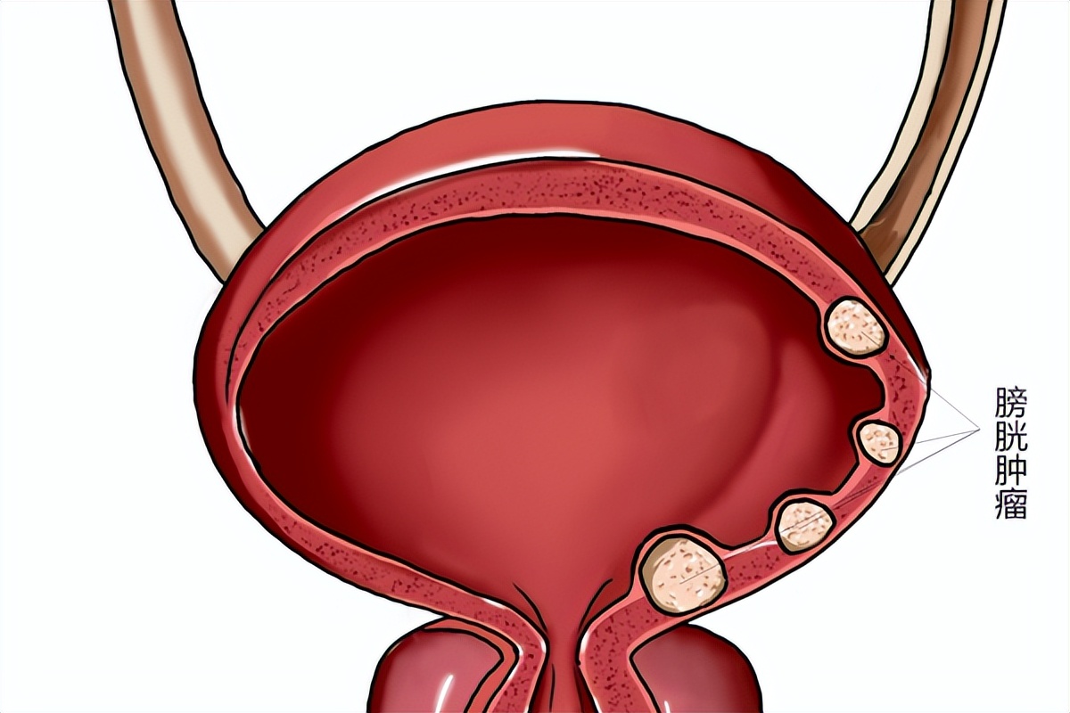 女性膀胱的位置图真人图片