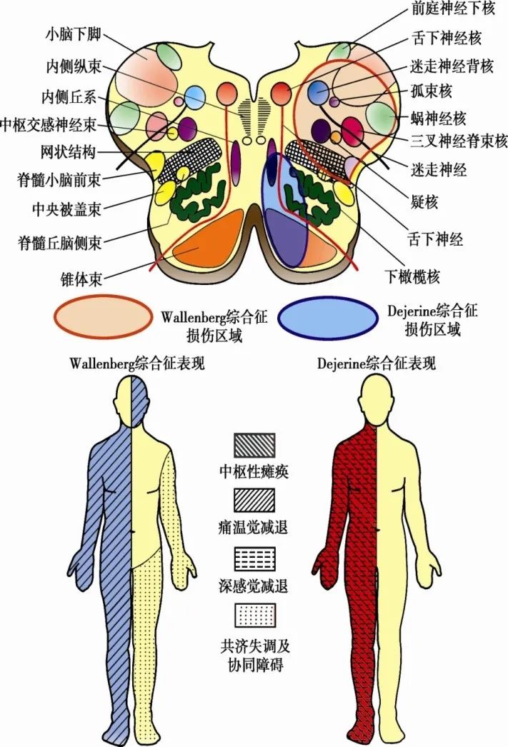 延髓外部的位置图图片