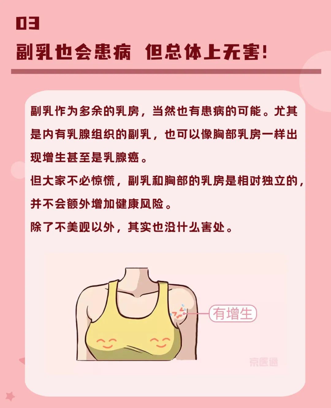 副乳是什么样的图片