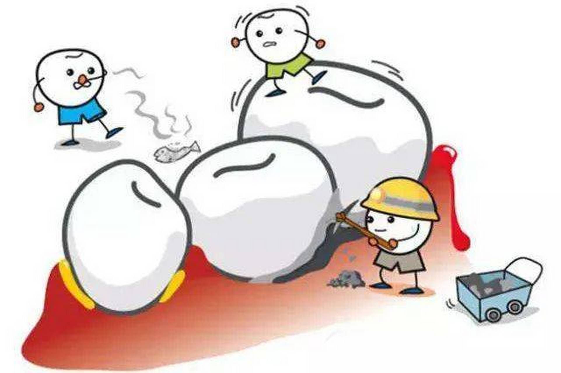 牙结石太严重会导致牙齿脱落!