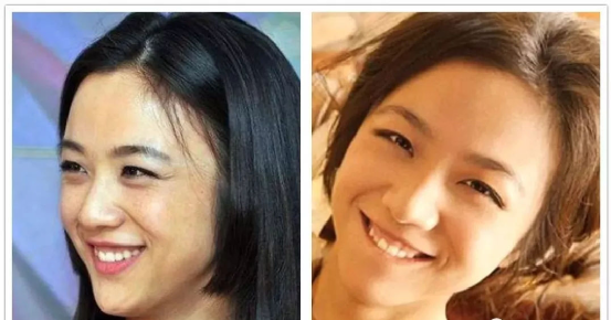 这9位笑起来露出牙龈的明星:高圆圆牙龈外凸,刘亦菲牙齿内扣