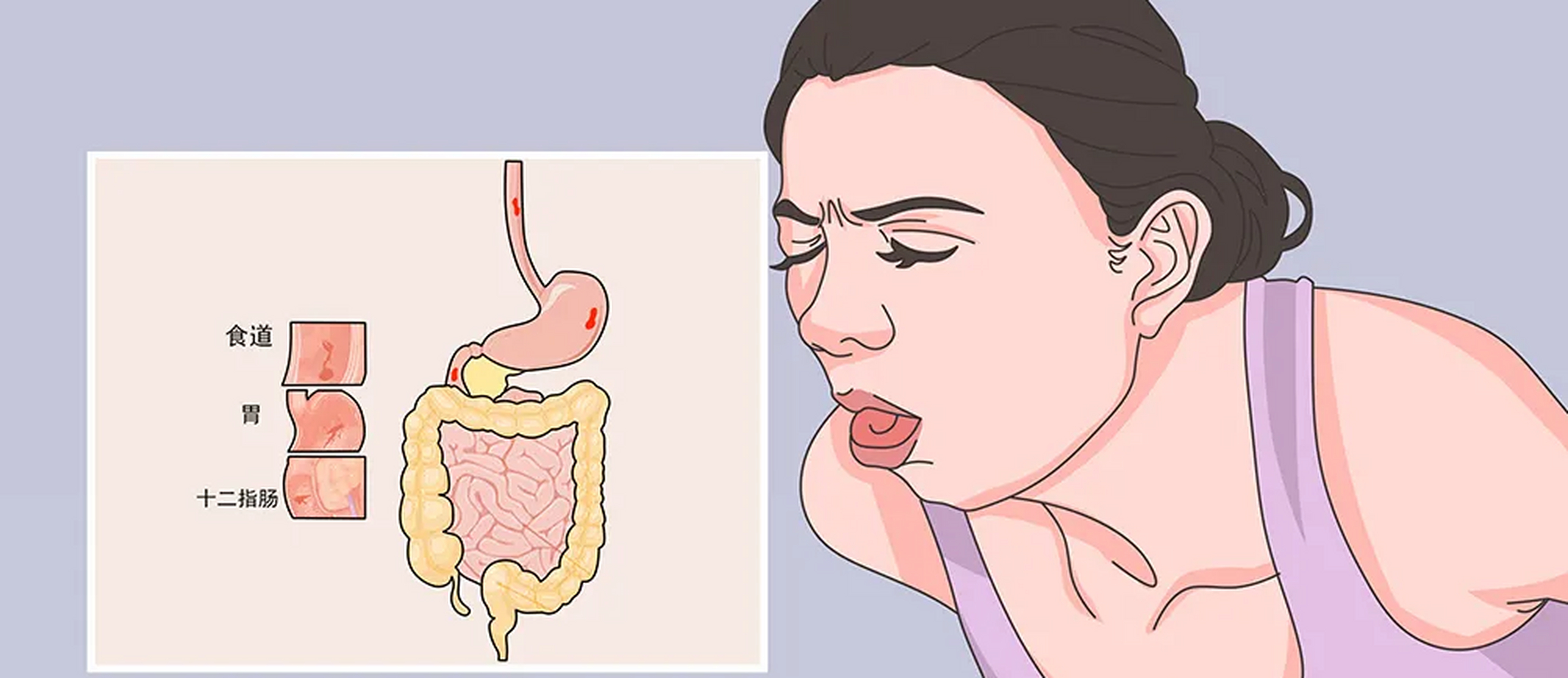 肝硬化上消化道出血是怎么回事,如何处理?