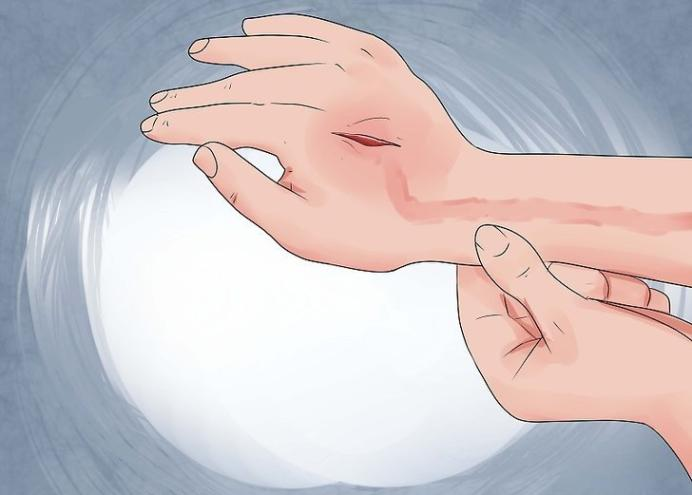 免疫力比较差的人,可能出现伤口愈合慢,两三天还没结痂的情况,甚至会