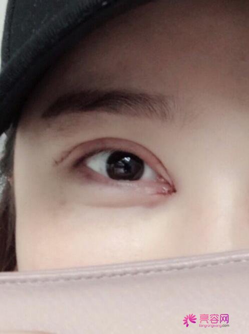 南方医科大珠江医院怎么样?2022整形价格表医生专家案例口碑经验