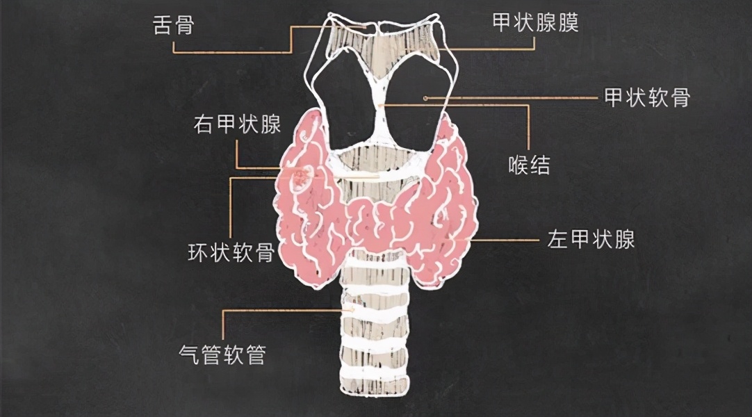甲状腺癌来临前,到底会有哪些症状?